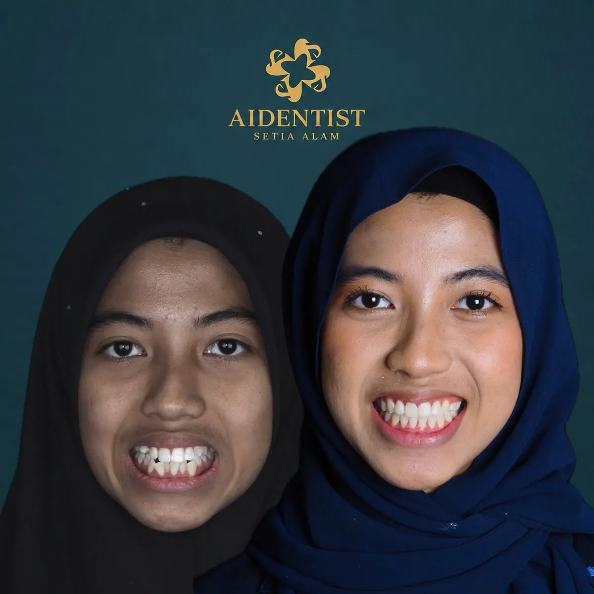Aidentist dental work case 1