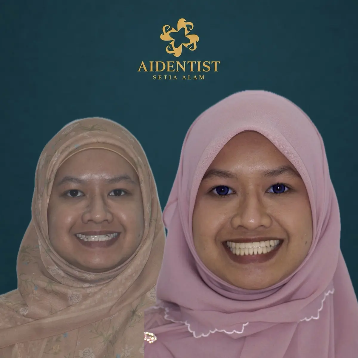 Aidentist dental work case 2
