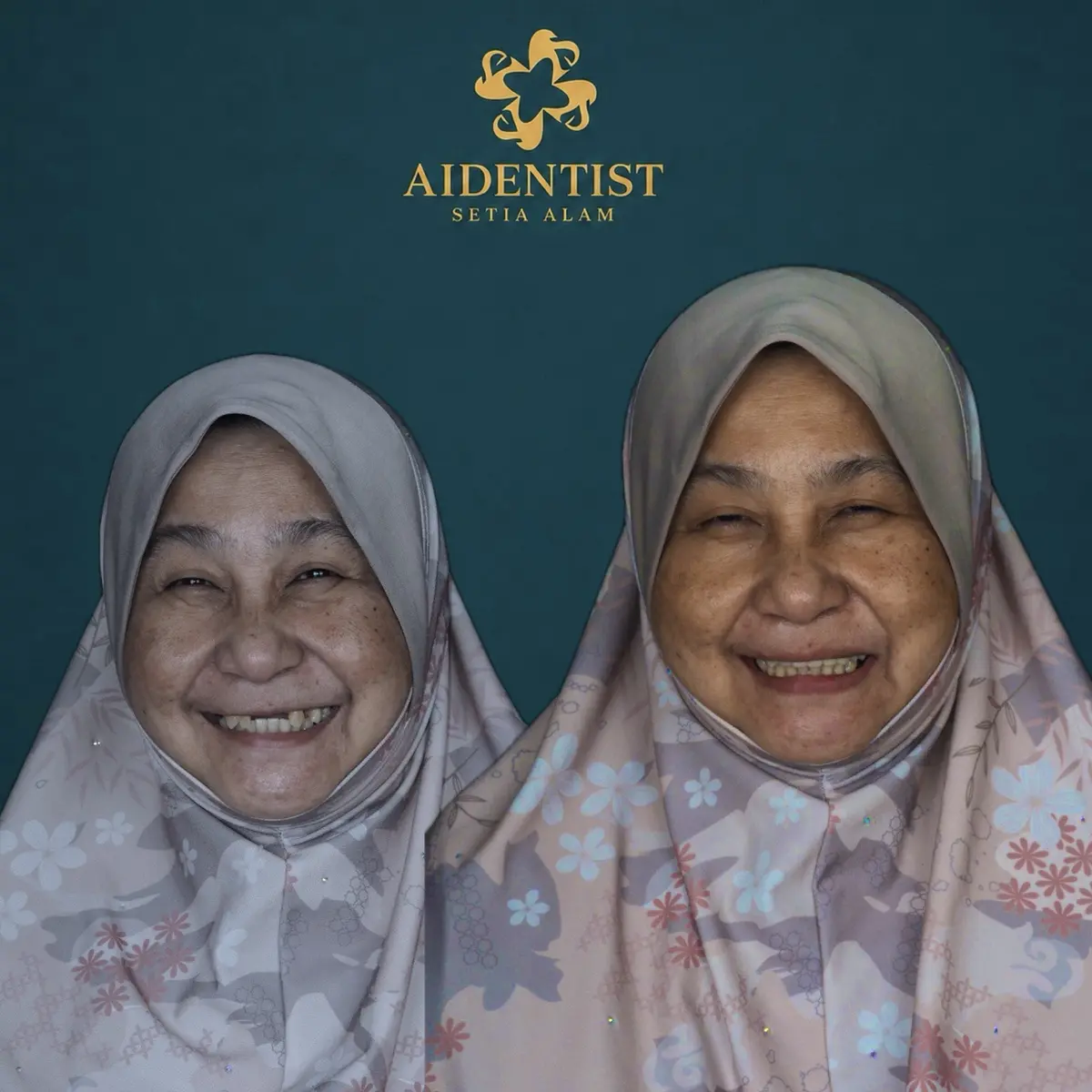 Aidentist dental work case 3