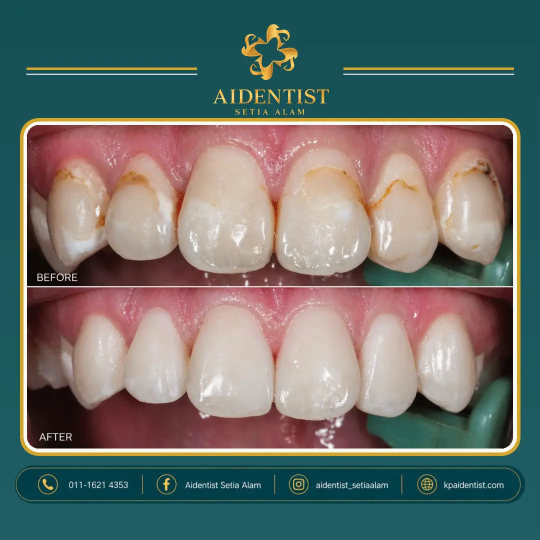 Aidentist dental work case 4