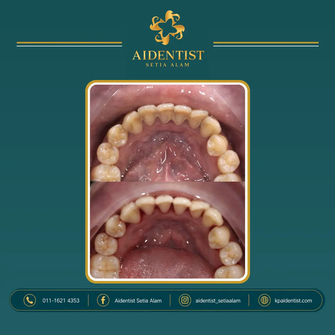 Aidentist dental work case 6