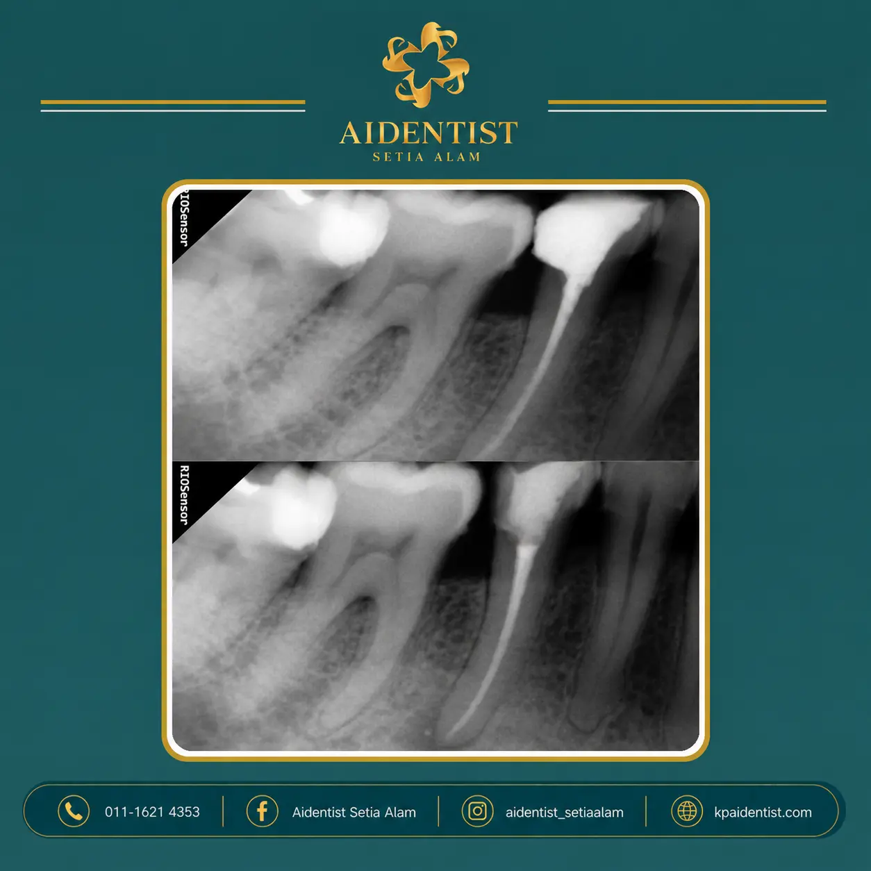 Aidentist dental work case 7